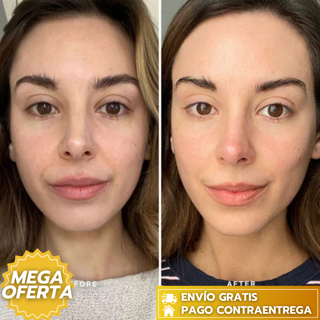 50%OFF MADECA CREAM  [Centellian24]™:Crema facial que reafirma, repara y rejuvenece la piel.