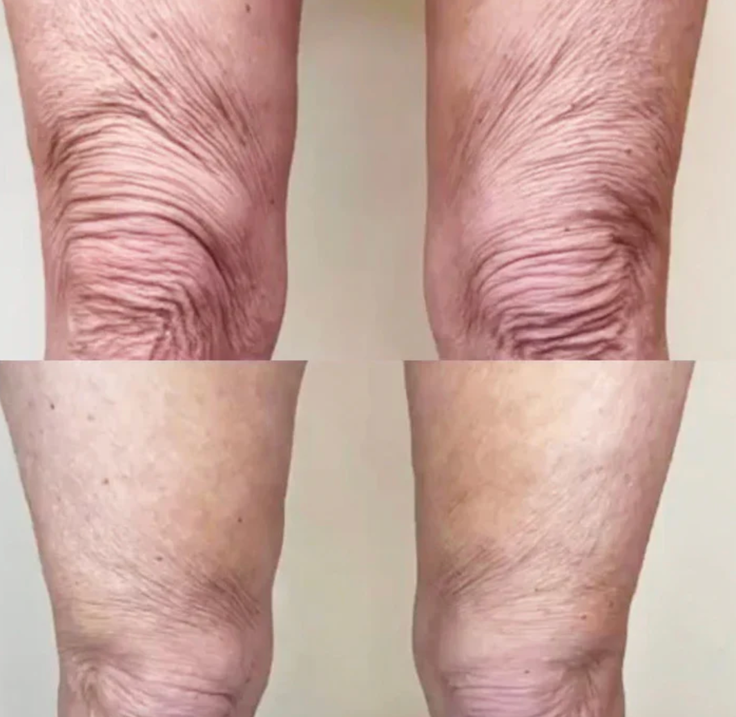 50%OFF 2X1 CREMA REAFIRMANTE HOYGI (Original): Reafirma visiblemente la piel y reduce la apariencia de flacidez