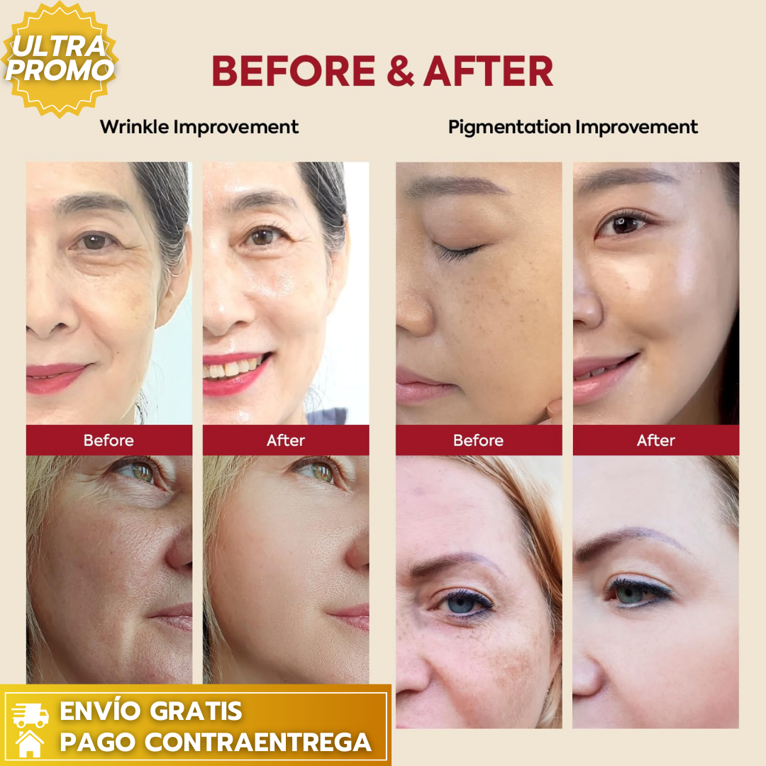 K-SECRET SEOUL 1988™: Serum de retinol para la cara, antienvejecimiento, cuidado de las arrugas