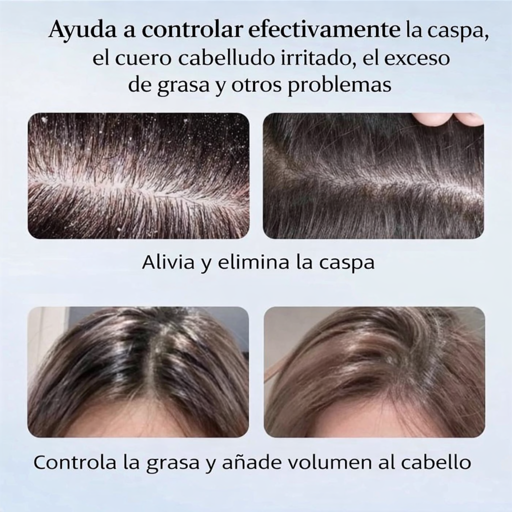 NIPPORI ANTICASPA XTREM™: Limpieza profunda medicada que controla grasa y caspa desde el primer uso.