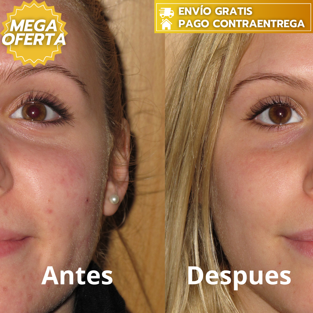 NIDA Youthful™: Crema reductora de líneas de expresión y arruguitas con Formula Ultimate A1