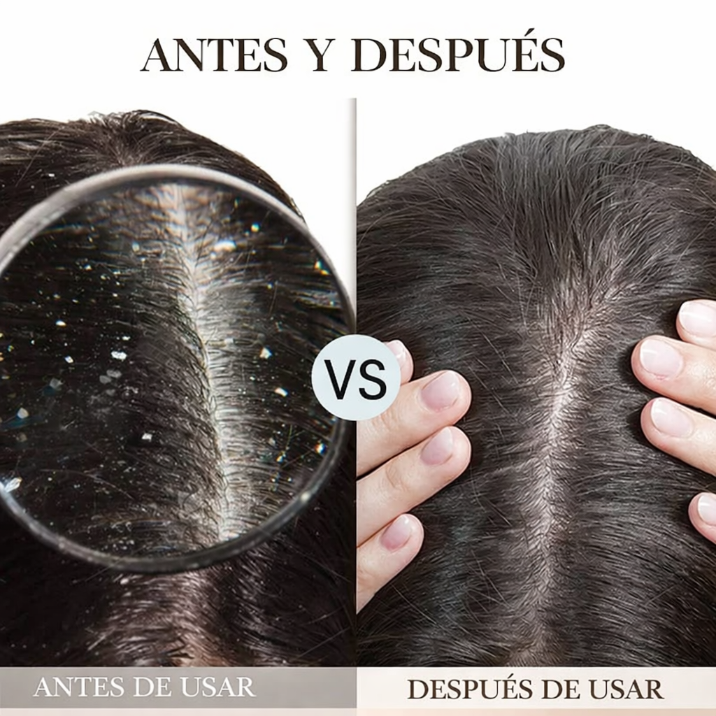 NIPPORI ANTICASPA XTREM™: Limpieza profunda medicada que controla grasa y caspa desde el primer uso.