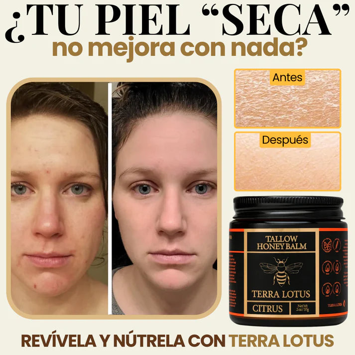 TERRA LOTUS™ (50%OFF): Bálsamo orgánico nutritivo que hidrata y repara la piel en profundidad.